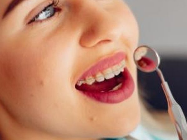 ما هو تقويم الاسنان وما هي اضراره